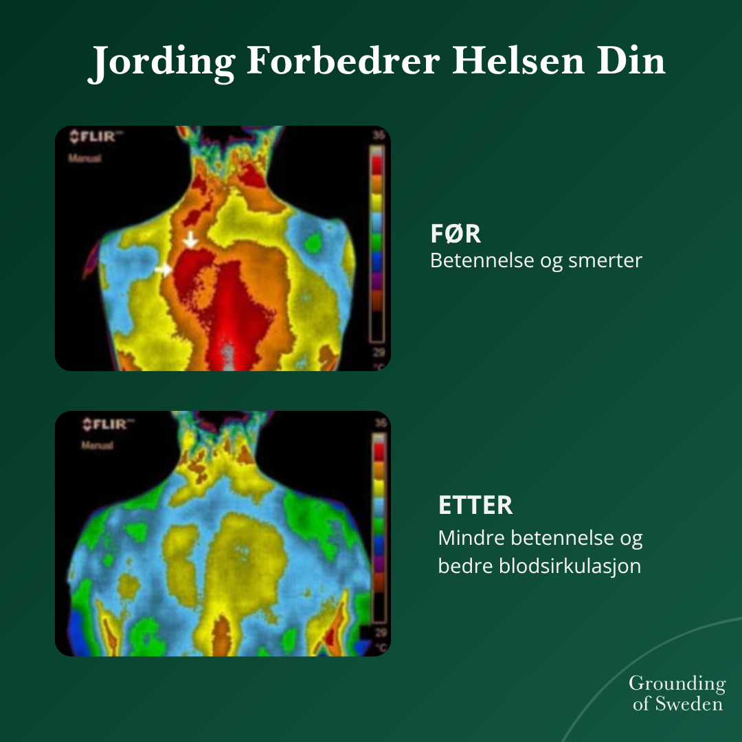 Føl Deg Best Hele Dagen Med Våre Allværs Jordingssko